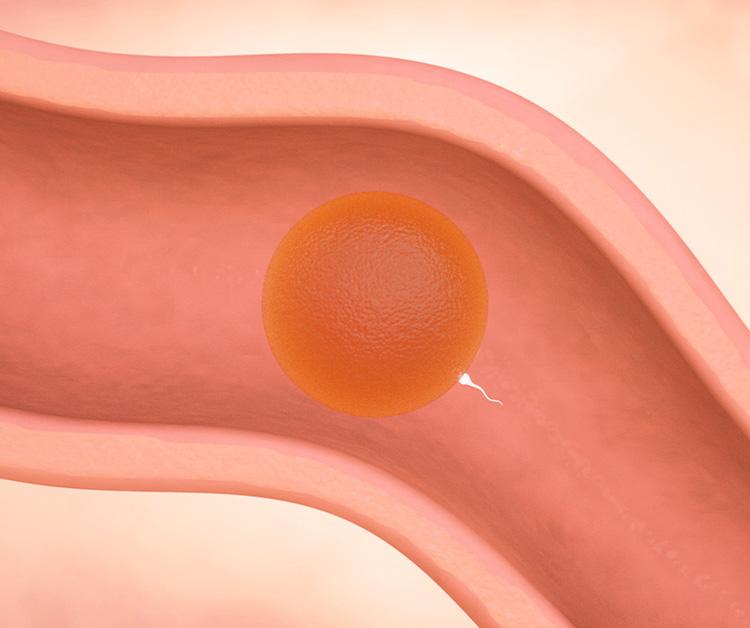 Sperm travels up the fallopian tubes to meet the egg